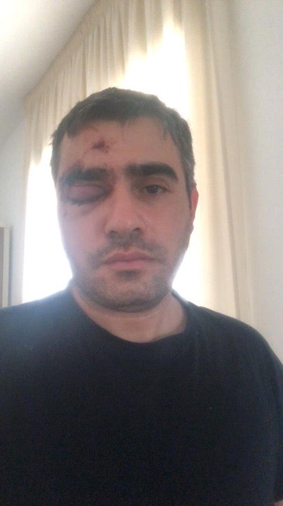 أصيب ربيع بركات في رأسه بخرطوشة غاز مما تسبب في كسر حول عينه اليمنى ونزيف داخلي في العين ونزيف في الدماغ