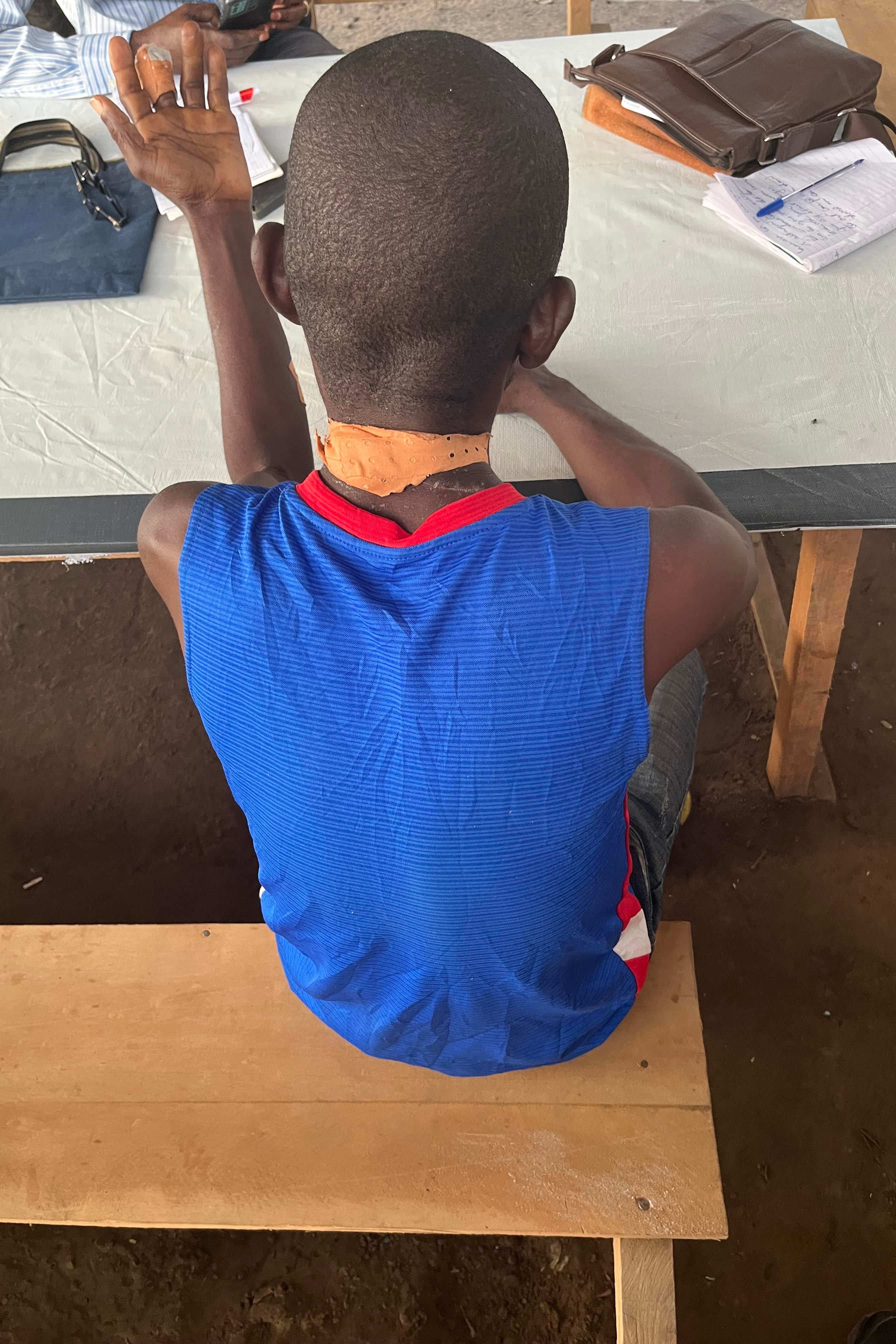 Un homme non identifié montre ses blessures