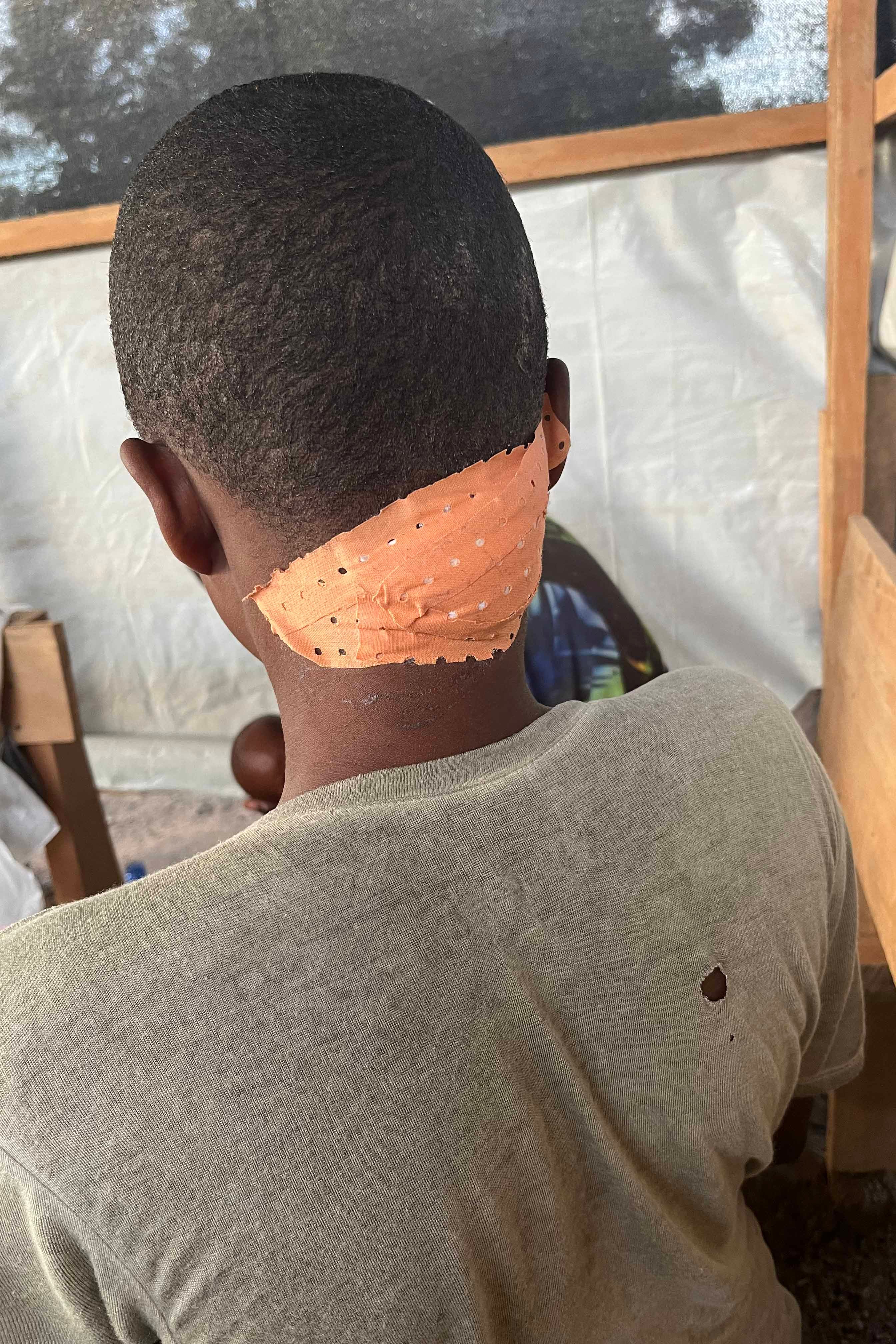 Une femme montre ses blessures