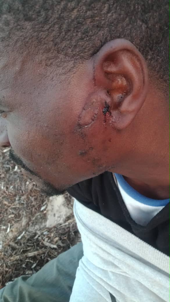 رجل طردته السلطات التونسية إلى الحدود الليبية في 2 يوليو/تموز 2023 يعرض جروحه.