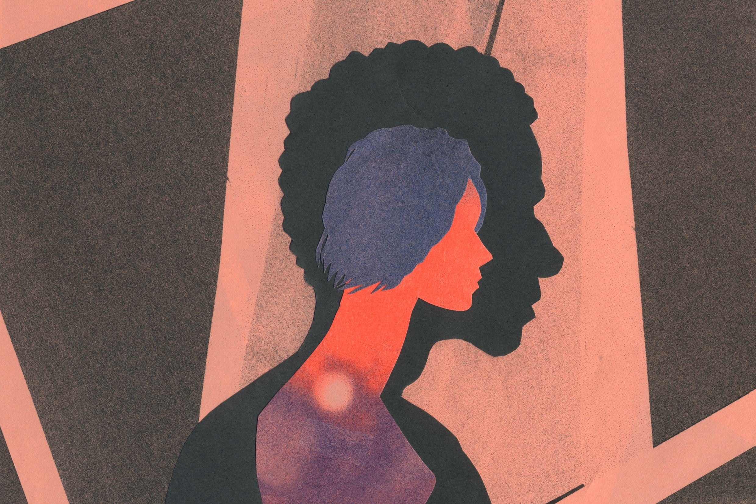 رسم يمثل الانزعاج الجندري