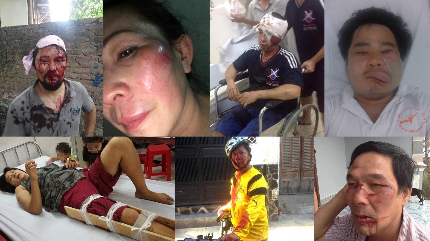 201706Asia_Vietnam_Assaults ML