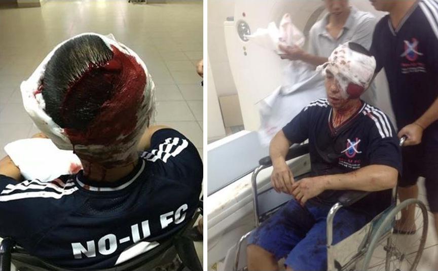 La Viet Dung after being assaulted in Hanoi on July 10, 2016.