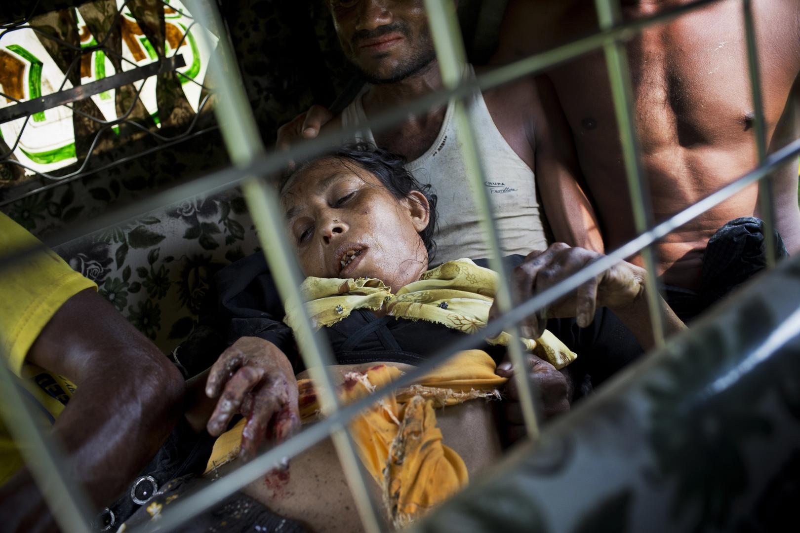 A Rohingya woman travels to a hospital near Kutupalong, Bangladesh, after a landmine blew off her right leg while she was crossing the border from Burma, September 4, 2017.