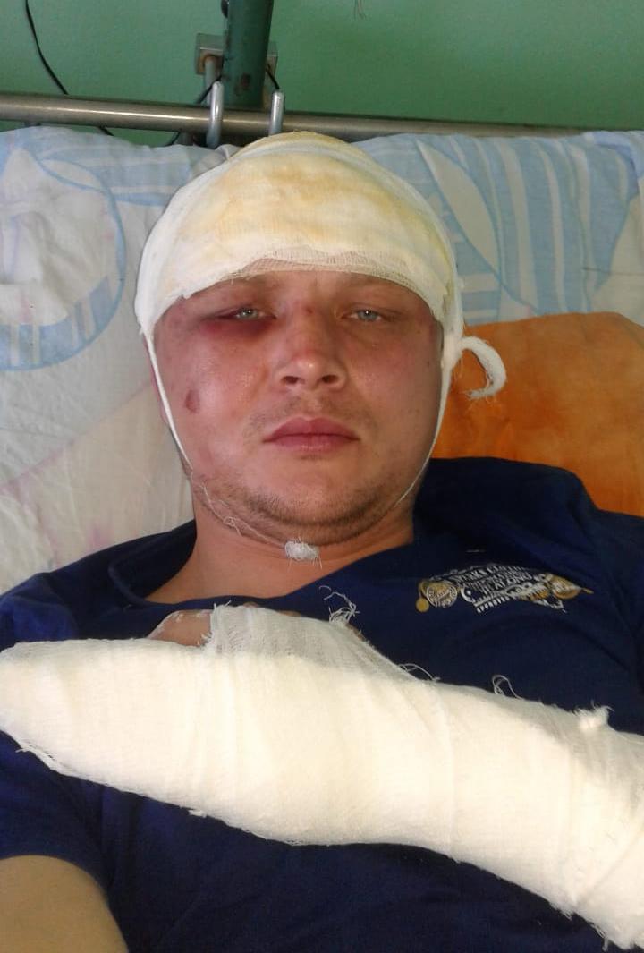 Trade union leader, Dmitry Senyavskii, in hospital, November 11, the day after unidentified assailants viciously attacked him in his garage. 