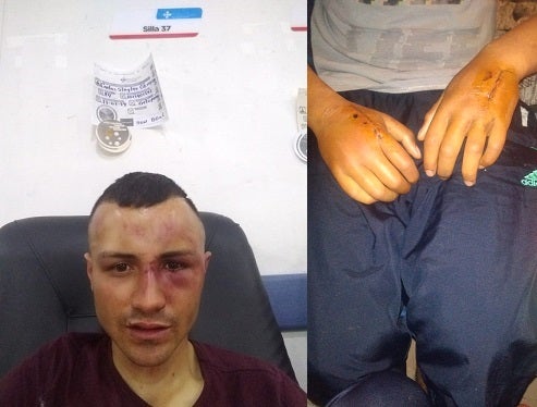 Carlos Steylei Obregón Ramírez en el Hospital Kennedy el 27 de noviembre de 2019.