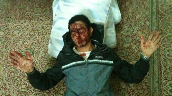 Sayed Ahmed al-Wadaei, un défenseur bahreïnien des droits humains, photographié en 2011 après avoir été violemment battu par les forces de sécurité.