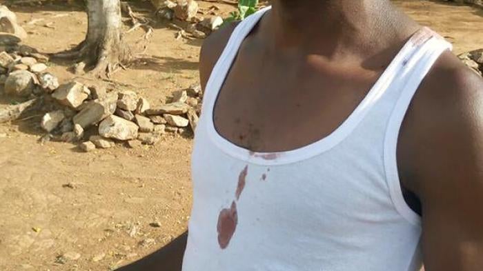 Standard newspaper journalist Isaiah Gwengi moments after being released by Kenya’s Quick Response Team police in Siaya, western Kenya, on March 23, 2017. The officers allegedly stripped, kicked and gun-butted him. 