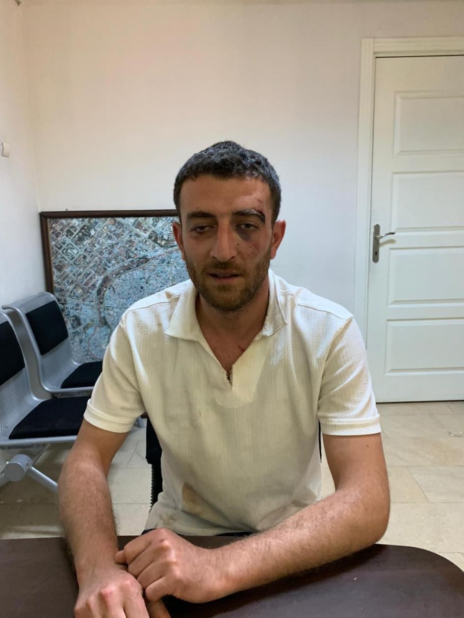 Koray Tosun, gözaltına alınmadan önce ve gözaltı sırasında polis memurları tarafından dövüldüğünü iddia ediyor.