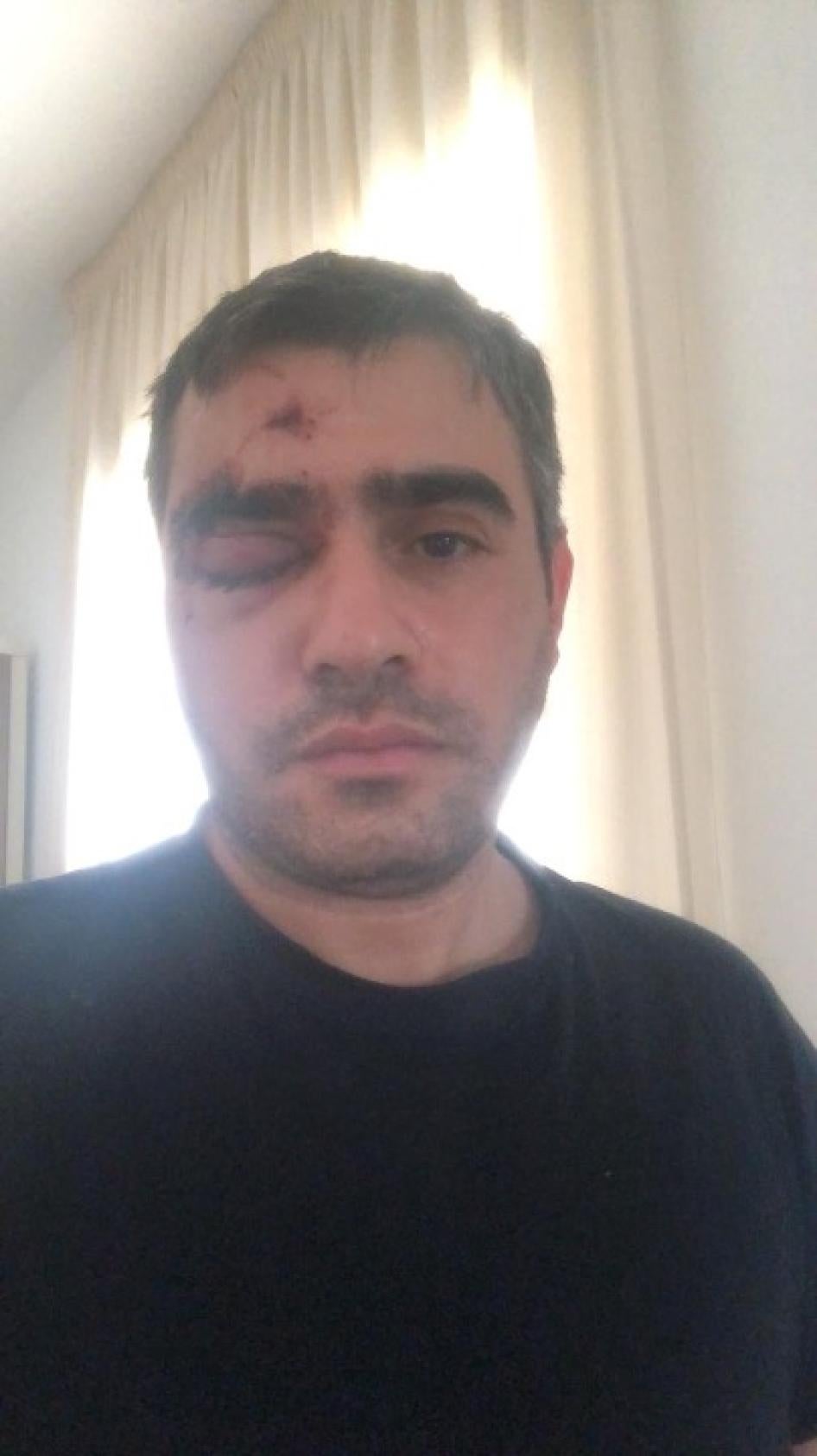 أصيب ربيع بركات في رأسه بخرطوشة غاز مما تسبب في كسر حول عينه اليمنى ونزيف داخلي في العين ونزيف في الدماغ