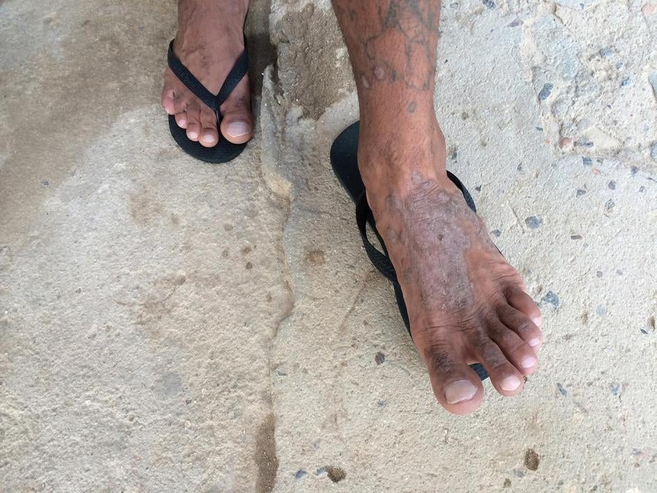 Um detento na Penitenciária Agro-Industrial São João