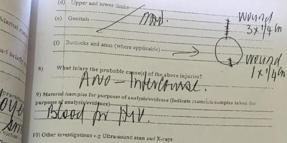 Ripoti ya matibabu iliyojazwa na daktari Kampla, Uganda baada ya kufanya uchunguzi wa lazima wa njia ya haja kubwa kwa mtu anaeshukiwa kujihusisha na mapenzi ya jinsia moja kwa hiari. 