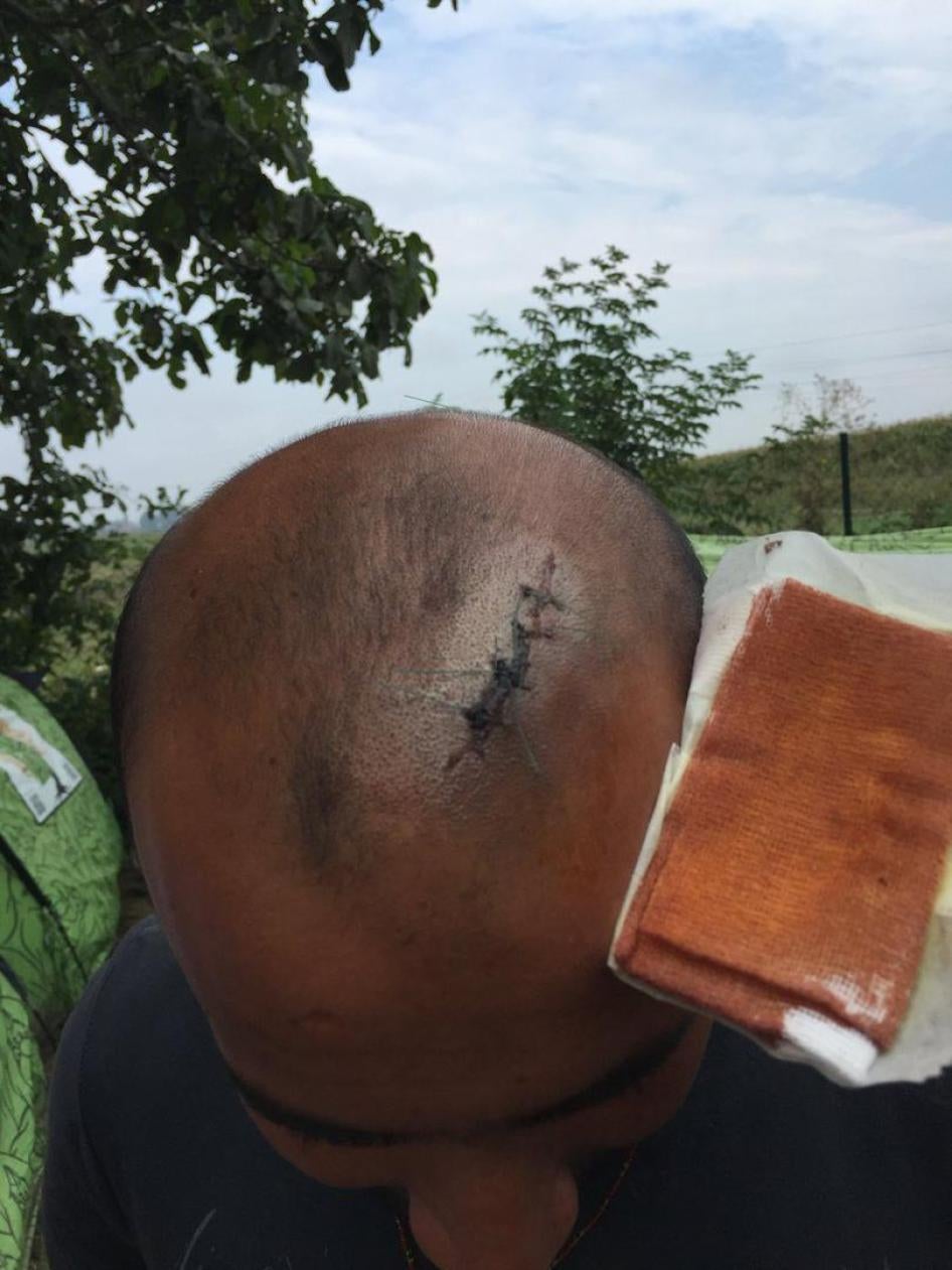 Pakistani man who said he was beaten by Hungarian border officials on August 12