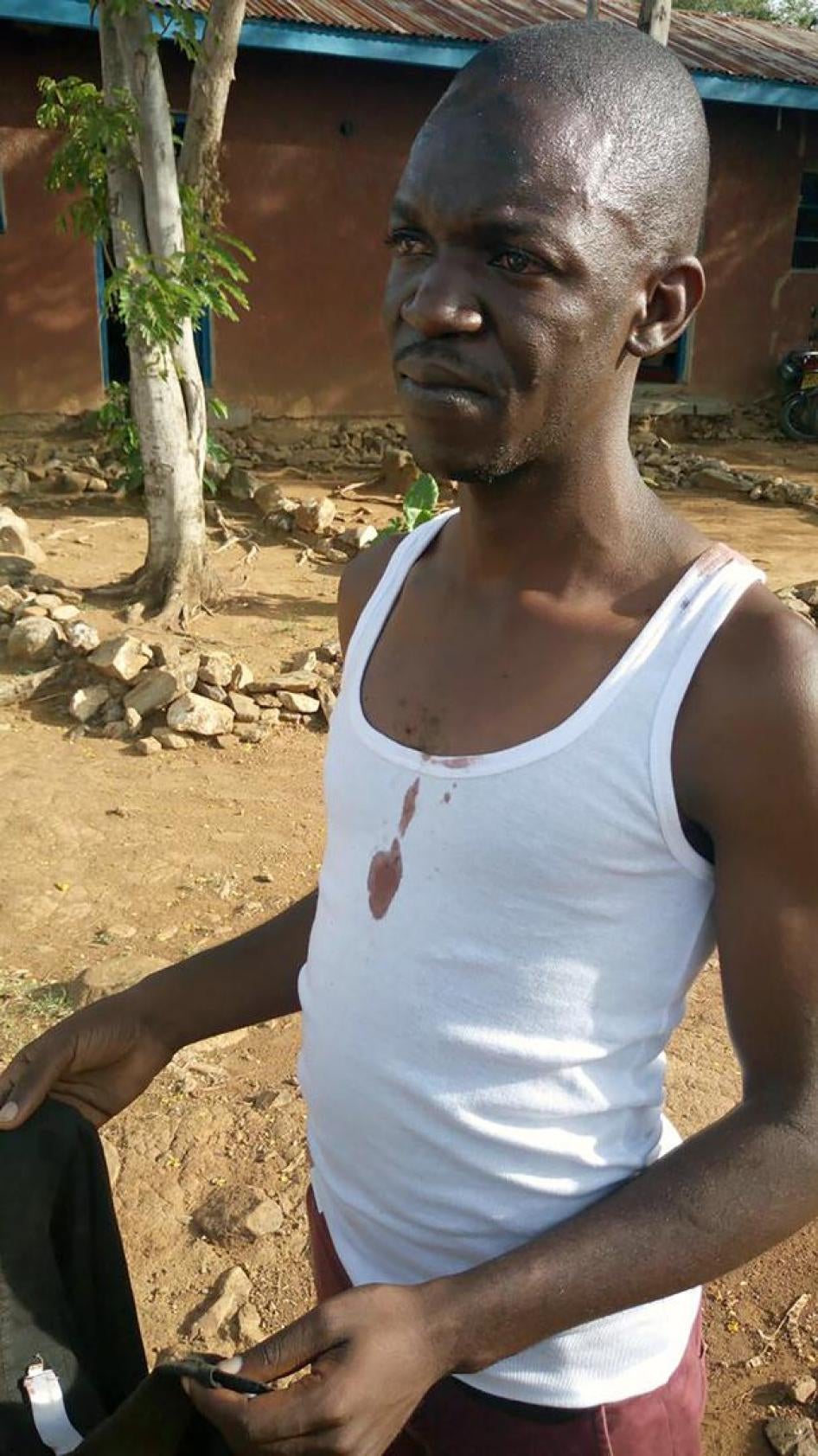 Standard newspaper journalist Isaiah Gwengi moments after being released by Kenya’s Quick Response Team police in Siaya, western Kenya, on March 23, 2017. The officers allegedly stripped, kicked and gun-butted him. 