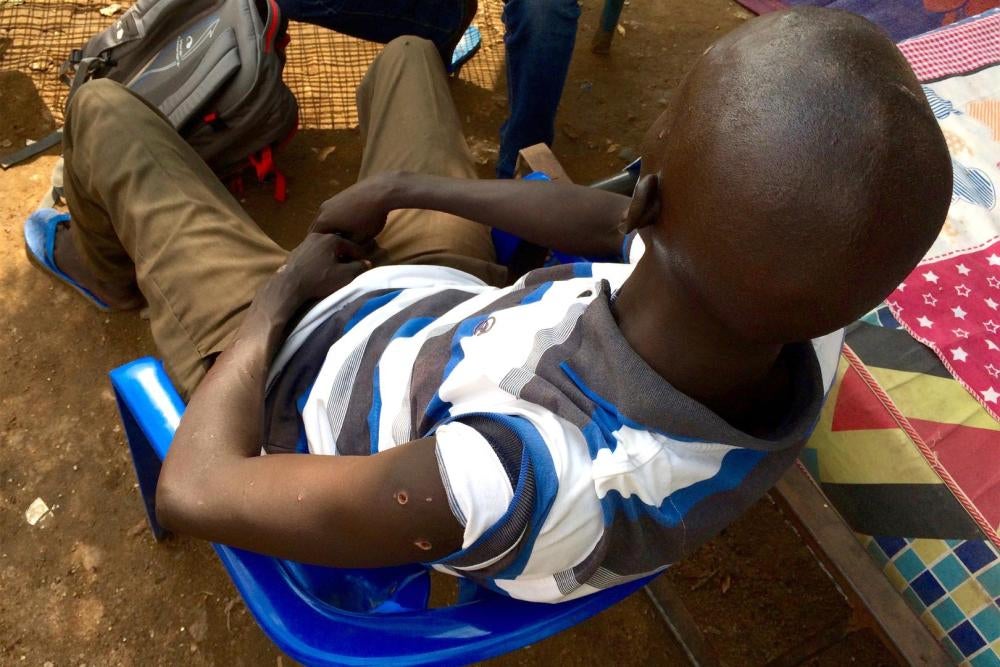 A Nuer male, shot 7 times by government soldiers at an impromptu checkpoint near Juba University on July 8, 2016. 