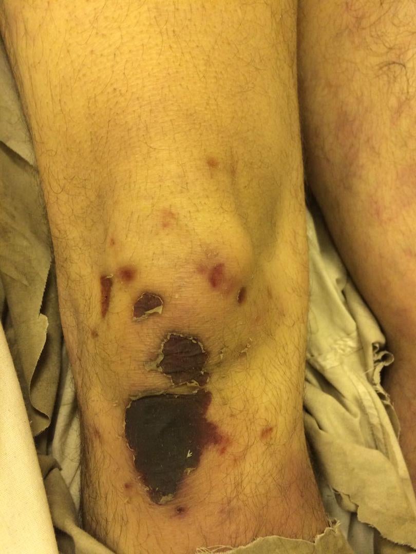 Photos of the bodies of three of the Syrians who died in military custody.