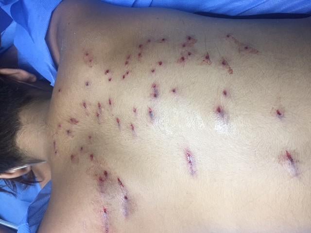 Back with bullet holes