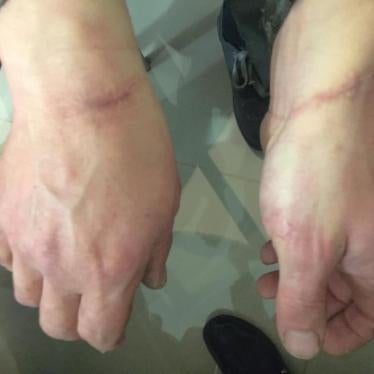 2016-11-28-eca-ukraine-donetsk-scars